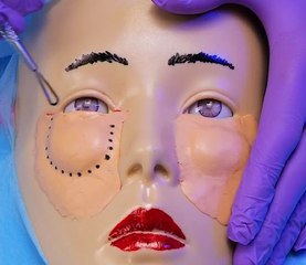 What Happens During Lower Blepharoplasty