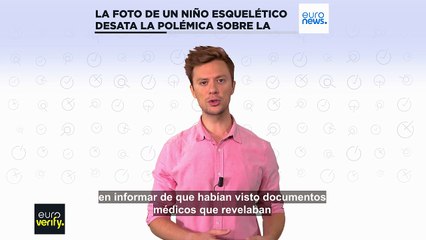 Euroverify: La foto de un niño esquelético desata la polémica sobre la hambruna en Gaza