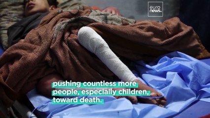 How malnutrition in Gaza is devastating children's health
