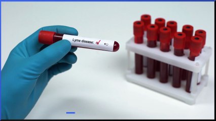 Lyme Disease is increasing - Here's what you need to know