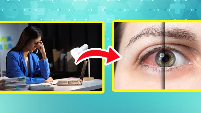 Vitamin Deficiency Causes Dry Eyes: Aankhon Mein Sukhapan Kyon Hota Hai,Treatment In Hindi | Boldsky