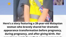 28‑year‑old Malaysian woman who bravely shared her dramatic appearance transformation