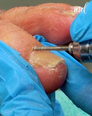 Feet treatment to make you feel royal 👑