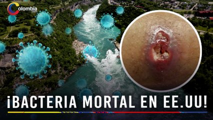 Alerta por bacteria come carne en EE. UU.: ya hay muertos y el riesgo va en aumento