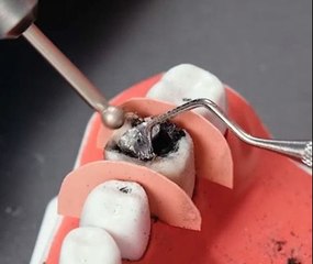 Magical power of dental procedures!