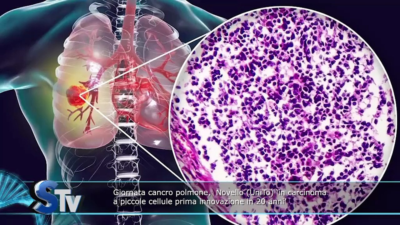 Salus tv n° 31 del 6 agosto 2025