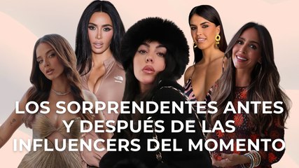 Los sorprendentes antes y después de las influencers del momento