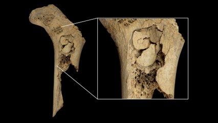 Se descubre que en Atapuerca hubo canibalismo humano hace 5.700 años