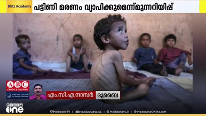 ഗസ്സയിൽ ഇസ്രായേലിന്റെ പട്ടിണിക്കൊലയിൽ മരിച്ച കുട്ടികളുടെ എണ്ണം 100 കടന്നു