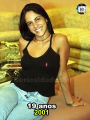 Antes e depois de Thammy Miranda .Confira a transformação na linha do tempo.