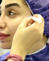 معجزه تزریق چربی صورت