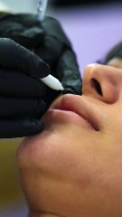 نکات مهم قبل و بعد از تزریق ژل لب در کلینیک نوین آریانا