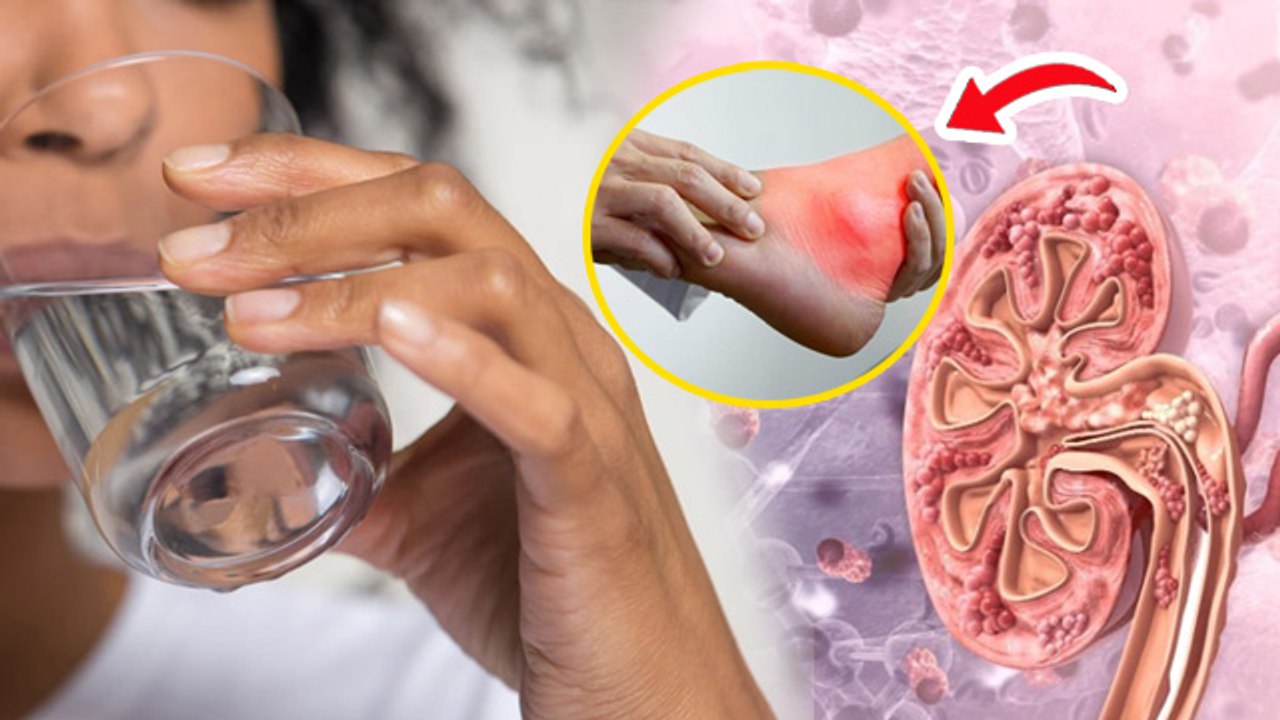 Uric Acid Kyu Badhta Hai,शरीर में पानी की कमी से होते है ये रोग | High Uric Acid Increase Reason....