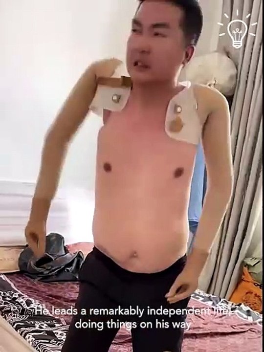 This armless man is not what I expected! 🥺