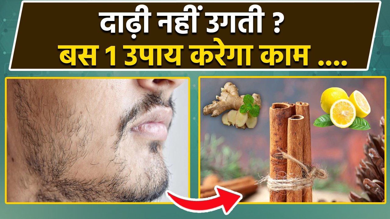 Dalchini Nimbu Daadhe Par Lagane Se Kya Hota Hai | Cinnamon & Lemon For Beard | Benefits In Hindi