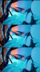 رضایت خانم عزیز از لیزر موهای زائد در کلینیک ایرانا