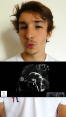 Ne frotte jamais tes yeux