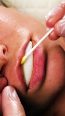 What Happened to My Lips Today Will Surprise You