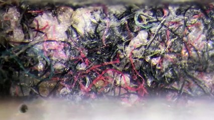 Phone Cleaning Done Under the Microscope.