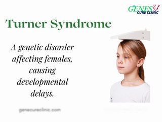 Turner Syndrome: Causes, Symptoms, and Management