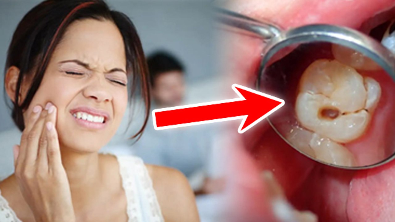 Tooth Cavity Causes: बिना दाँत निकाले कैविटी कैसे ठीक करें,Treatment In Hindi | Boldsky