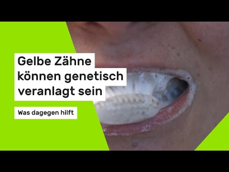 Gelbe Zähne können genetisch veranlagt sein: Was dagegen hilft