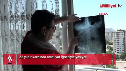 Hastanede ortaya çıktı: 22 yıldır karnında: 'Canlı bomba gibi geziyorum'