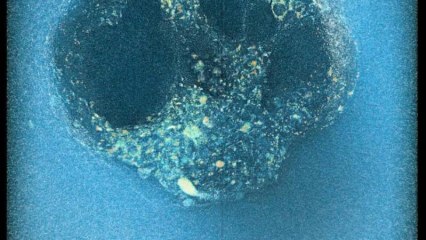 Científicos españoles graban por primera vez el proceso de implantación de un embrión humano en tiempo real