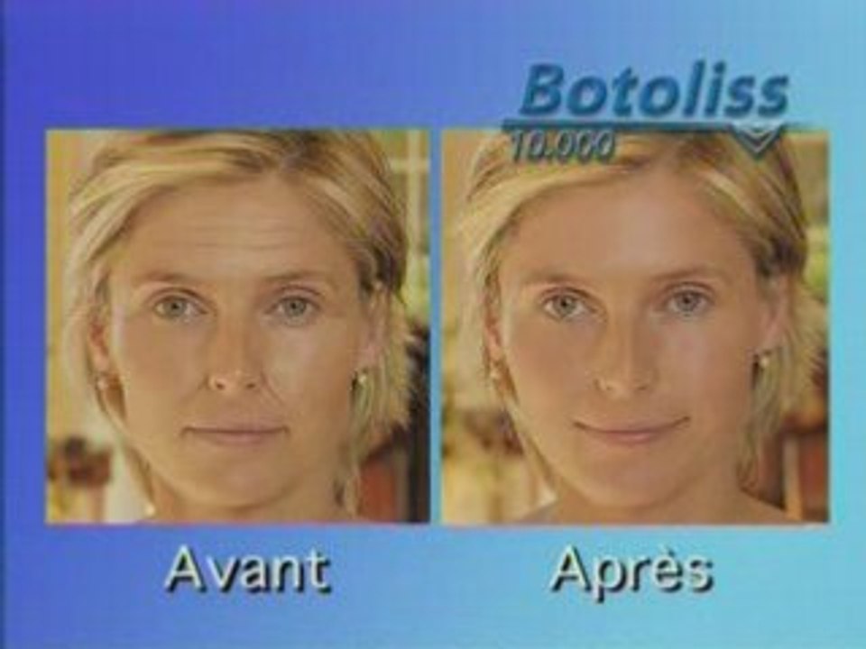 BOTOLISS Anti Rides 69,90 Euros Livraison Gratuite