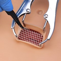 Secrets of body surgery explained