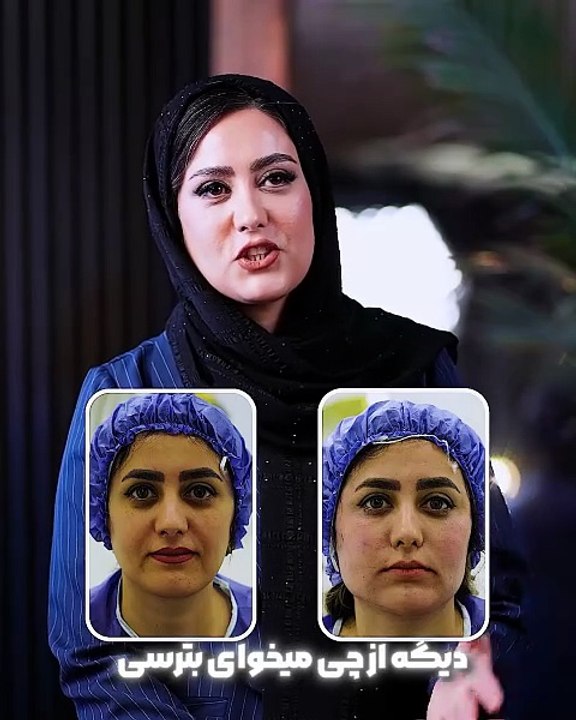 اهمیت استفاده از کرم ضدآفتاب برای جلوگیری از پیری زودرس