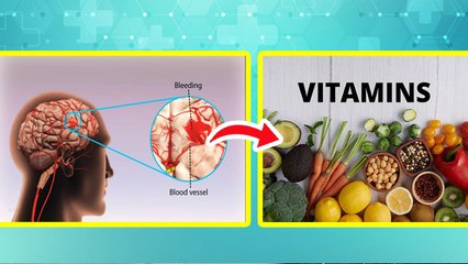 किस विटामिन की कमी से ब्रेन हेमरेज होता है | Kis Vitamin Ki Kami Se Brain Hemorrhage Hota Hai