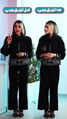 بایدها و نبایدها قبل و بعد از تزریق چربی | نتیجه بهتر با مراقبت صحیح