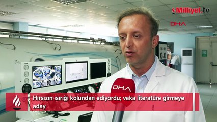 Elini ısıran hırsız yüzünden kolu kesilecekti!