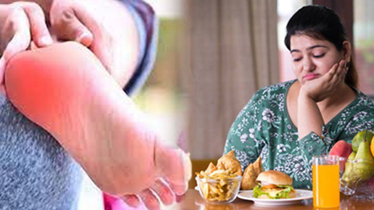 High Uric Acid Arthritis Me Kya Khana Chahiye, Food To Eat & Avoid, Full Diet Plan...|Boldsky