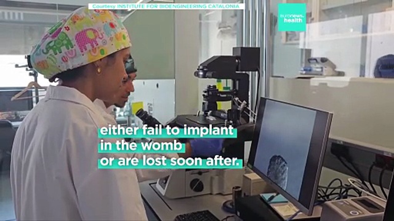 Spanish doctors created an artificial womb to solve a major cause of miscarriage