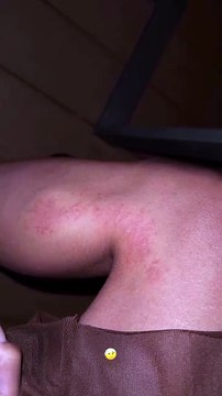 Μαριαλένα Ρουμελιώτη: Ατύχημα στις διακοπές της (Βίντεο)