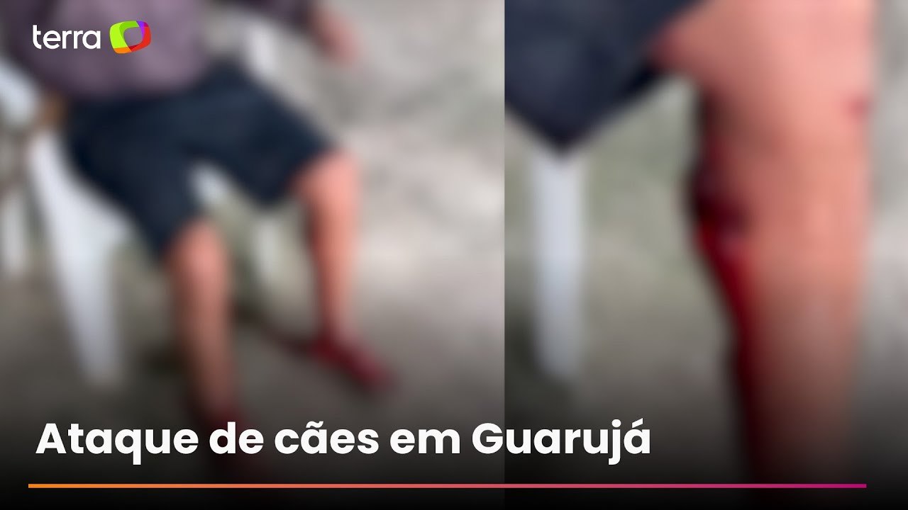 Homem tem múltiplos ferimentos nas pernas após ser atacado por cachorros no litoral de SP