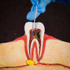 How operations look like - Simulation to understand 🏥