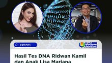 Hasil Tes DNA Ridwan Kamil dan Anak Lisa Mariana