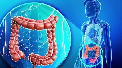 आंत खराब होने के लक्षण कारण और बचाव I  Intestine Damage Symptoms,Reason I Watch Video