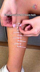 How to Close Wounds Fast Without Medical Tools