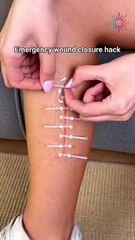 How to Close Wounds Fast Without Medical Tools