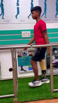 Patient from Jharkhand 💗 | Prosthetic Leg | Artificial Leg | Below Knee Prosthetic Leg | Amputation in Delhi | Prosthetic Leg Types | Ossur India | Ossur Clinic |