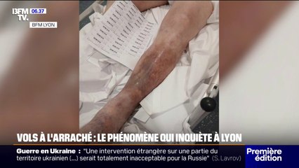 Lyon: recrudescence des vols à l'arraché