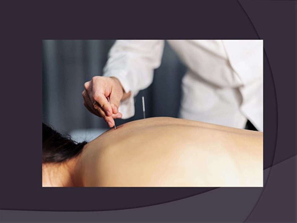 Why Are Acupuncture Needles in High Demand for Pain Management Now?