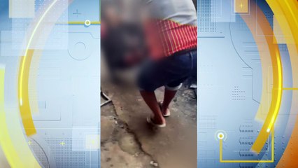 Idoso de 72 Anos Atacado por Cachorro em Depósito de Reciclagem na Zona Oeste do Recife: Estado de Saúde e Detalhes do Incidente