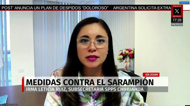 Chihuahua encabeza brote de sarampión con más de 4500 casos confirmados