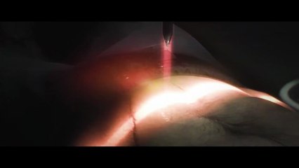 Dying Light The Beast - Part 1 Torture & Suffering Trailer