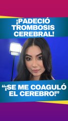 Olga Mariana revela cómo superó una trombosis cerebral a los 24 años